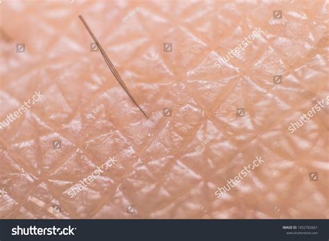 5,169 imágenes de Human skin microscope - Imágenes, fotos y vectores de stock | Shutterstock