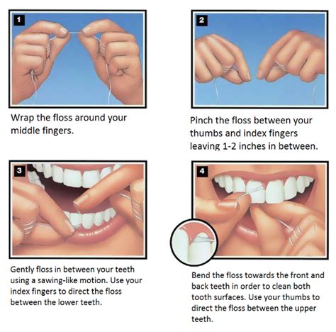 Flossing 101 | Beautiful Smiles Family Dental Center