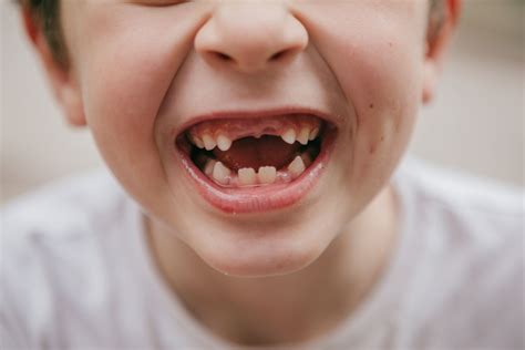 When do kids start losing teeth? Expert guide to baby teeth