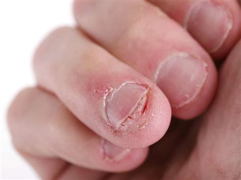 HOW TO REPAIR SPLIT NAILS - Health GadgetsNG