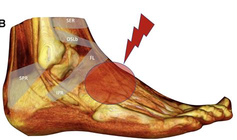 Is There A Tendon On The Top Of Your Foot Sale | emergencydentistry.com