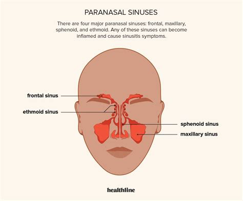 How To Get Rid of a Sinus Headache Instantly? - Infrared for Health