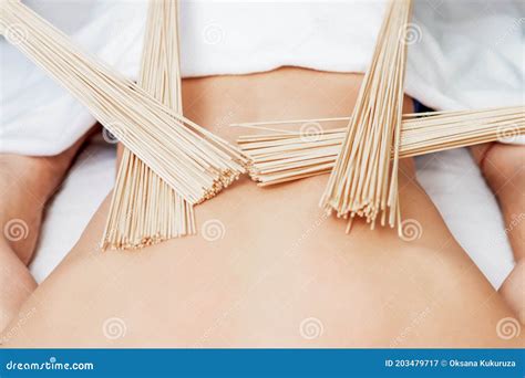 Back Massage with Bamboo Brooms Stock Image - Image of body, concept ...