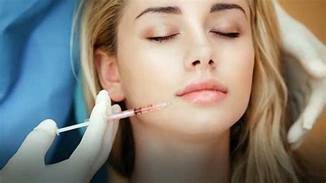 What is Juvederm - Expectations & Side Effects - video Dailymotion