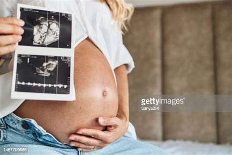 73 Human Embryo Twins Stock Photos, High-Res Pictures, and Images - Getty Images