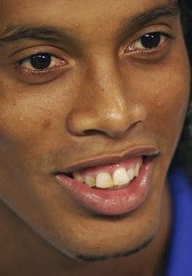 Photos: Footballer Ronaldinho pays $58,000 to get his teeth fixed ...