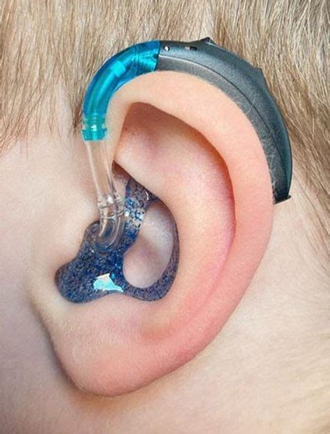 Phonak Hearing Aids in 2024 | Hearing aids accessories, Phonak hearing aids, Hearing aids