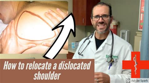 how to put a shoulder back, dislocated shoulder treatment - YouTube