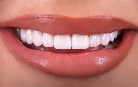 What Do You Know About Dental Veneers | Free Nude Porn Photos