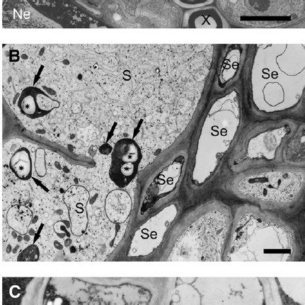 Transmission electron microscope picture of syncytia induced in roots ...