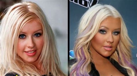 49 Celebrities Before and After Plastic Surgery - Клиника лазерной эстетики "Перлина".