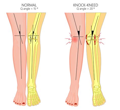 Surgery-Podiatry Cert Surgery