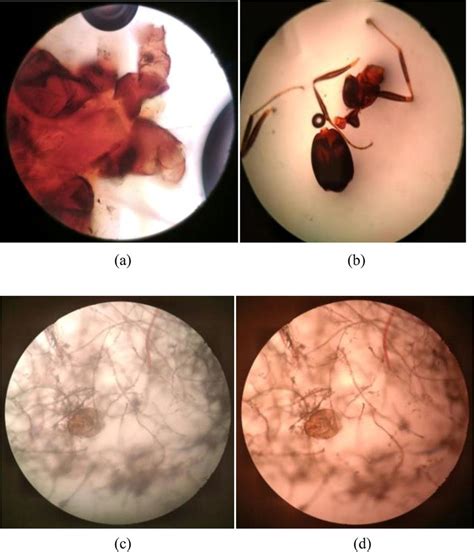 Dust Mite Microscope