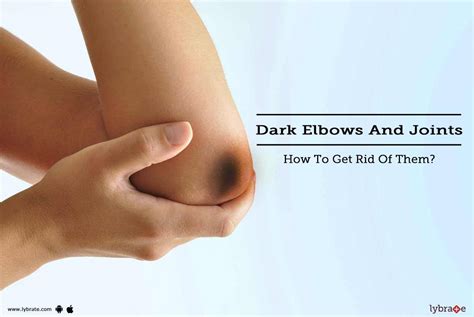 Dark Elbows And Joints - How To Get Rid Of Them? - By Dr. Sonal Chavan ...