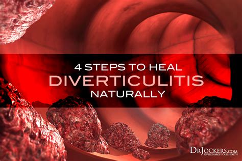 Diverticulitis can be an extremely unpleasant condition. Discover 4 steps to heal diverticulitis ...