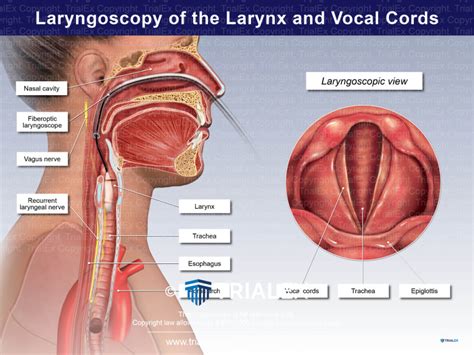 Laryngoscopy of the Larynx and Vocal Cords - TrialQuest Inc.