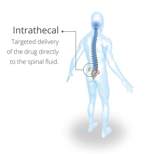 LIORESAL® INTRATHECAL (baclofen injection) - Lioresal® Intrathecal