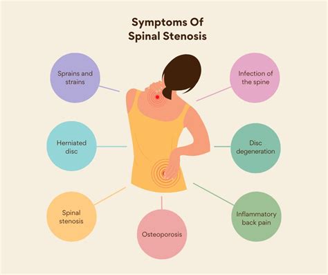 Spinal Stenosis | Causes, Treatment & Preventions