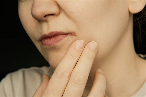 How To Get Rid Of Cold Sore Scars As Quickly As Possible