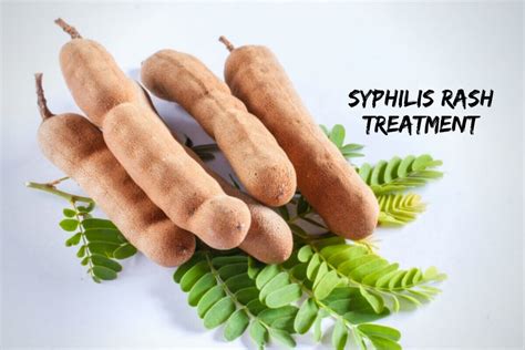 Syphilis Rash: What Is Syphilis & Its Treatment?