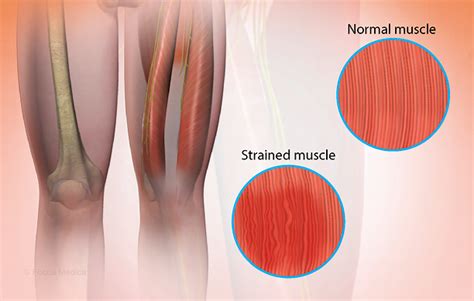 Health Condition : Symptoms, Causes, Treatment and More