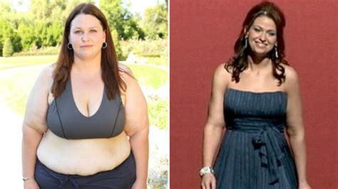 Extreme Makeover Weight Loss Jackie