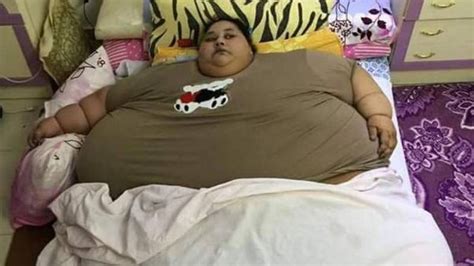 World’s Fattest Woman To Undergo Surgery in India