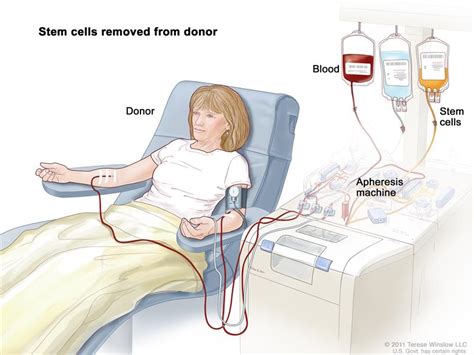 Become a stem cell donor today | Kempton Express