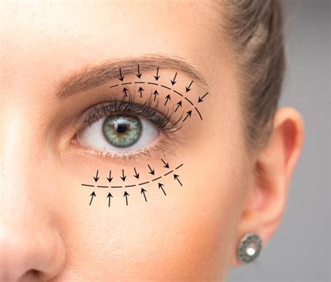 Are There Risks Associated With Eyelid Surgery? | Plastic Surgery | Buffalo