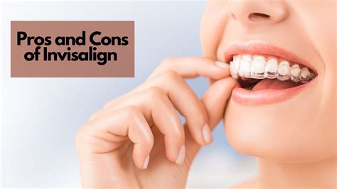 Pros and Cons of Invisalign - Beautiful Smiles Dental Center