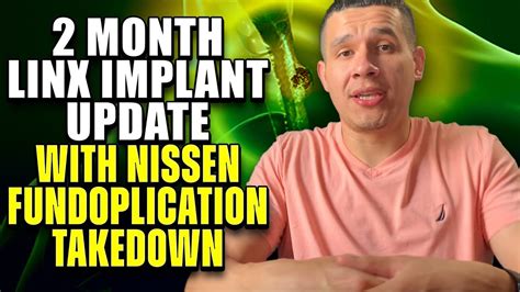 LINX Surgery (2- Month Update with Nissen Fundoplication Takedown ...