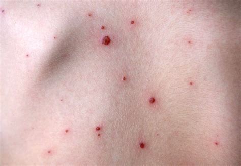 Common Skin Diseases and Conditions Explained