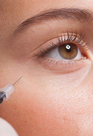The Dos and Don'ts of Botox | Botox, Botox injections, Botox fillers