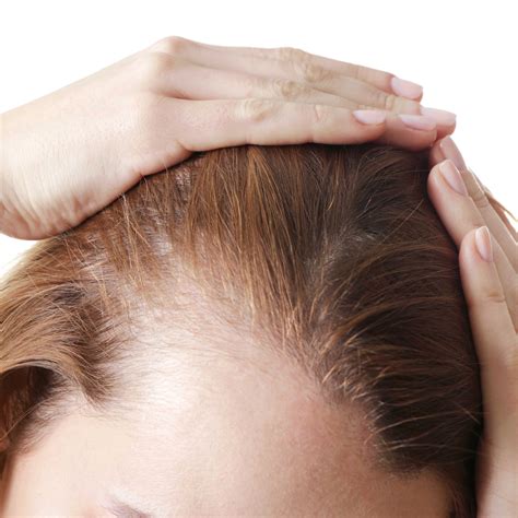 Thinning hair: Causes, treatments and prevention - Human Hair Exim