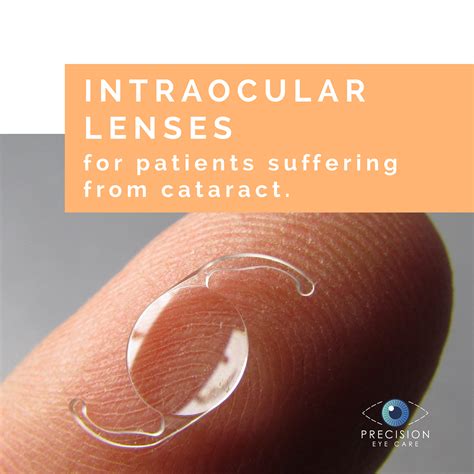 Intraocular Lens (IOL) - Precision Eye - Cataract and Laser Eye Surgery - Optometrist ...