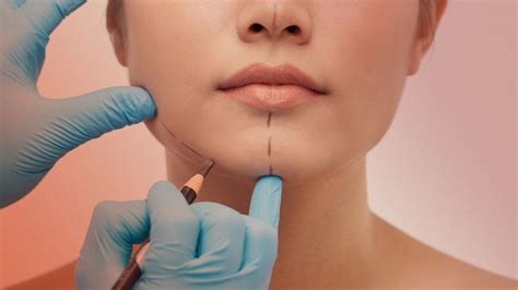 Experts Predict the Biggest Plastic Surgery Trends for 2023 | Allure | Plastic surgery, Plastic ...