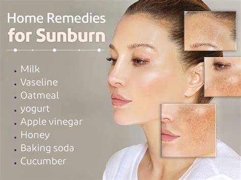 How To Remove Sunburn From Skin Naturally at Aubrey Durham blog