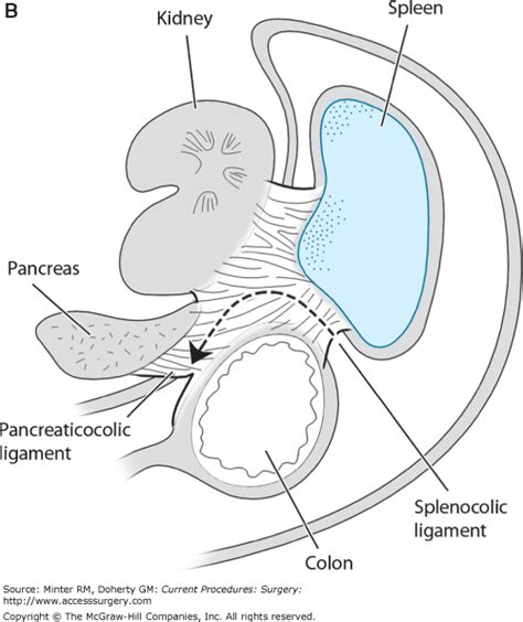 Semi Hemi Colectomy Diet - dallasinter