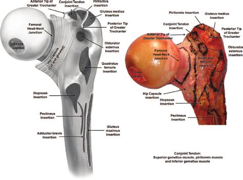 (9) Surgically Relevant Bony and Soft Tissue Anatomy of the Proximal Femur | Anatomy, Tissue ...