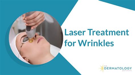 Laser Treatment for Wrinkles Removal - YouTube