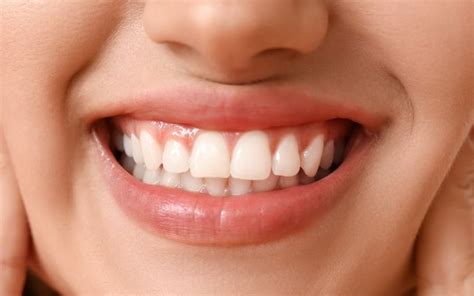 Healthy Gums: 8 Best Easy Tips To Keep Your Gums Healthy