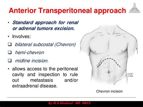 Access to urinary system v2