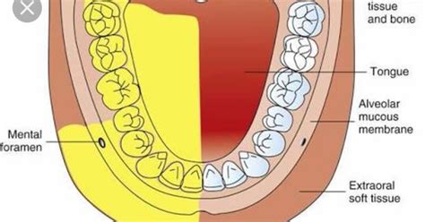 INFERIOR ALVEOLAR NERVE BLOCK