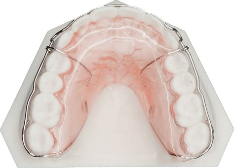 Hawley Retainer Upper - Protec Dental