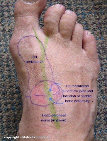 Distribution of the deep peroneal nerve | MyFootShop.com