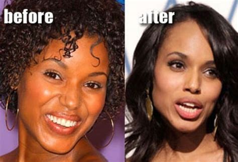 Kerry Washington Plastic Surgery Has No Conclusive Evidences