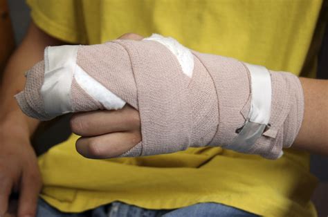 Sports Injuries | Hand Treatment and Causes | OrthoIndy Blog