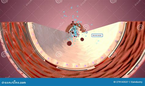 Ace Inhibitors, High Blood Pressure Stock Illustration - Illustration ...