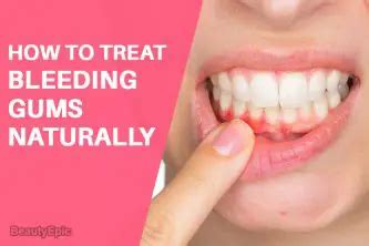How to Treat Bleeding Gums: 10 Home Remedies to Try