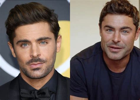 Zac Efron's new face: Actor explains why he had surgery [watch] | Zac ...